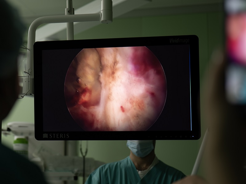 Ендоскопична урологія ендоскопична урологія