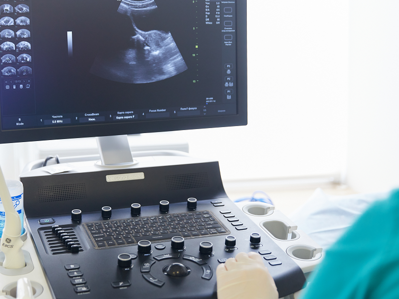 узд гінекологія