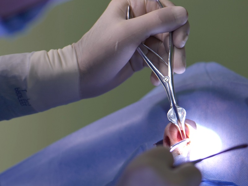 Операція на викривленній носовій перетинці в Києві операція на викривленній носовій перетинці