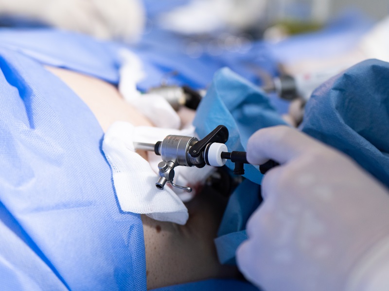 лапароскопія цистектомія