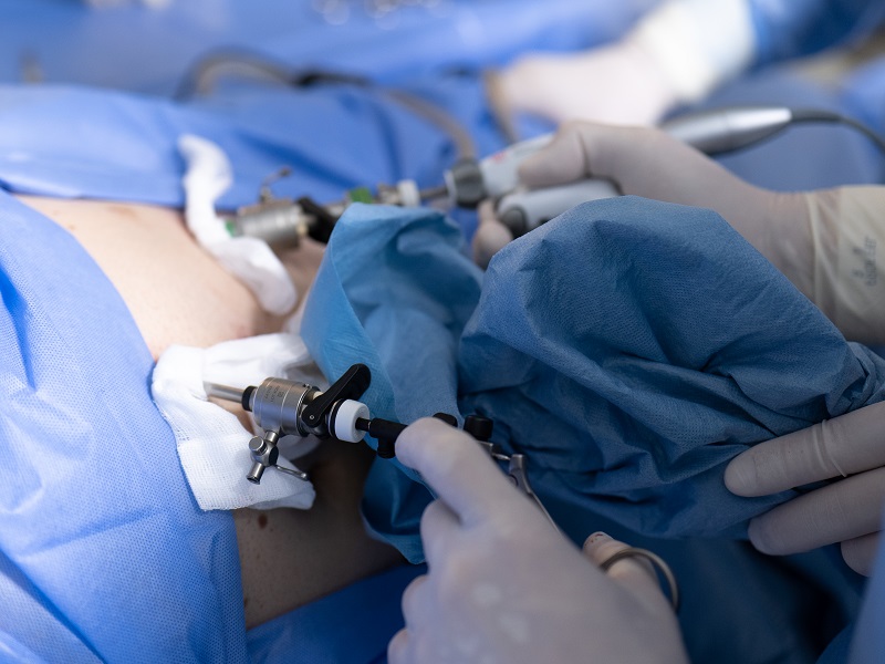 Лапароскопічна нефректомія в Києві нефректомія нирки