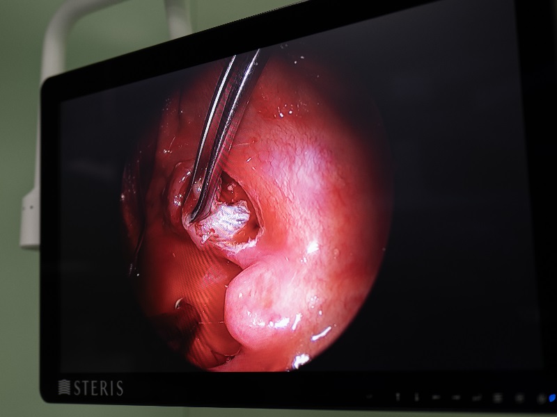 ЛОР хірургия в Києві ЛОР хірургия