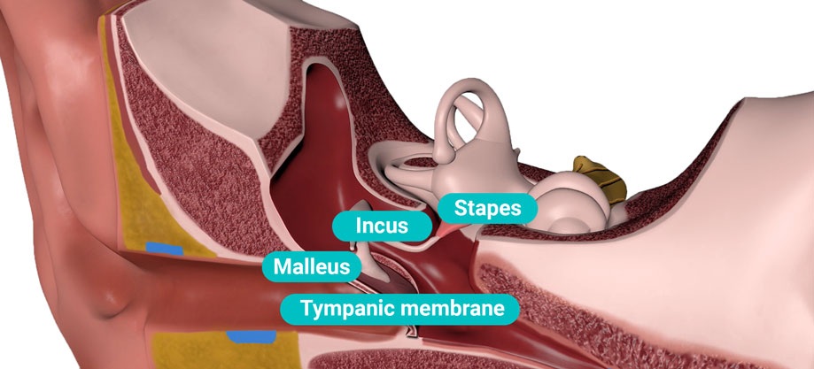 Стапедопластика в Києві стапедопластика