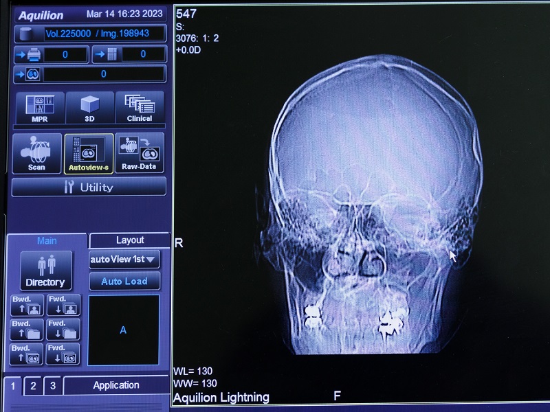 КТ головы в Киеве