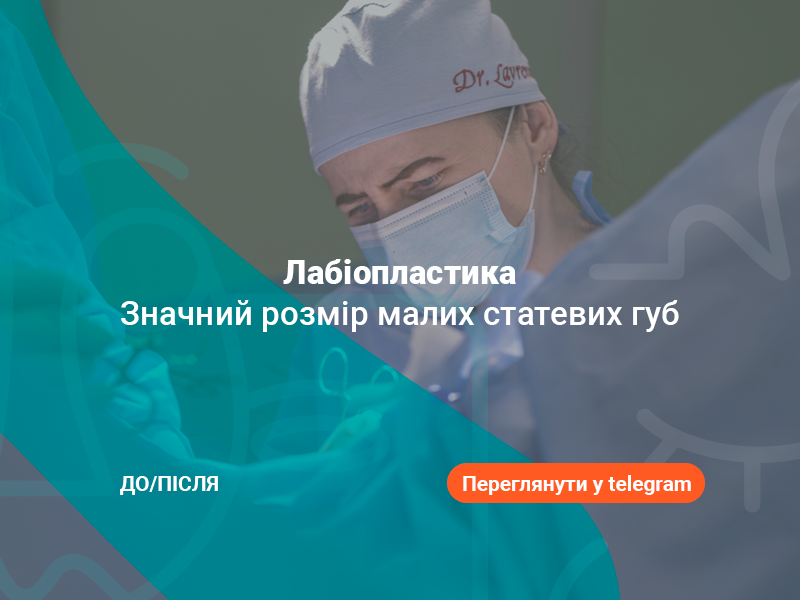 изменение размера половых губ