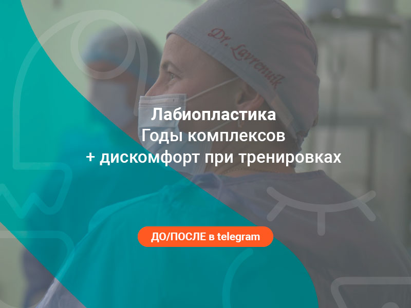 лабиопластика комплекс