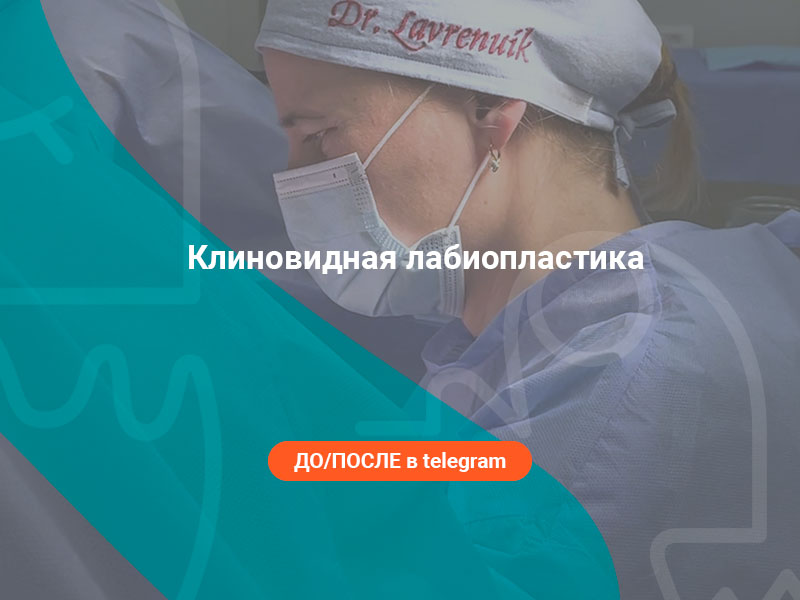 пластика