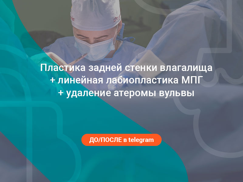 атерома вульвы