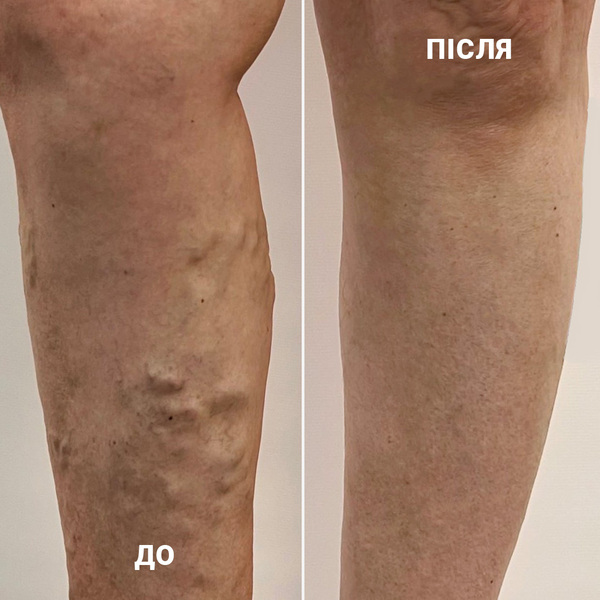 сосудистый хирург