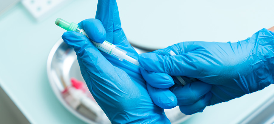 Білірубін загальний