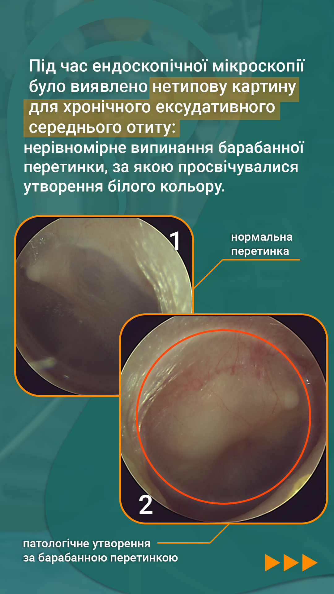отоскопия