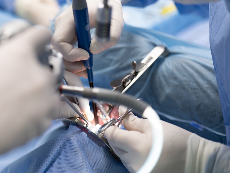 лікування рака глотки