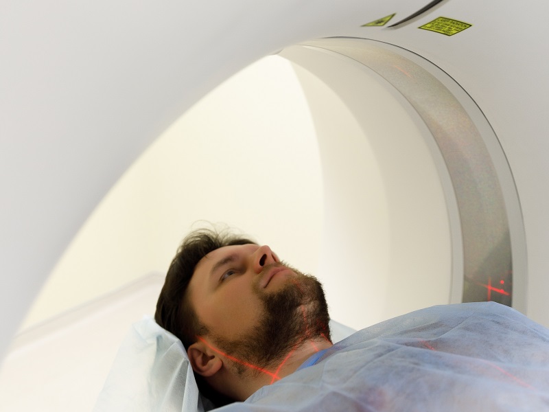 КТ обследование мозга