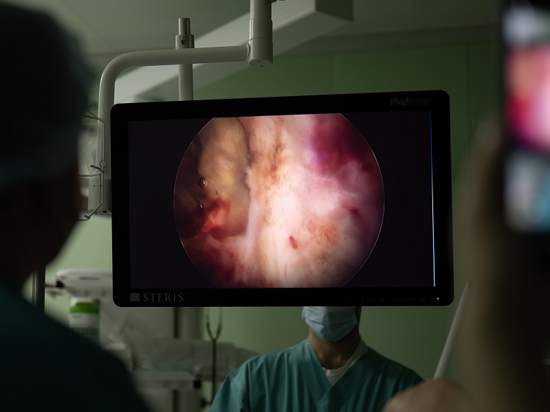 Видалення передміхурової залози через уретру ТУР простати