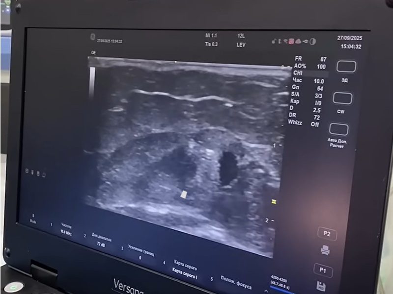 судинна хірургія судинна хірургія