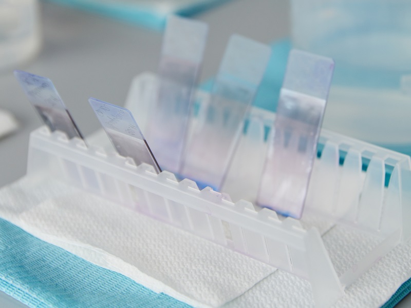 Аналіз на онкологію Консультация гинеколога