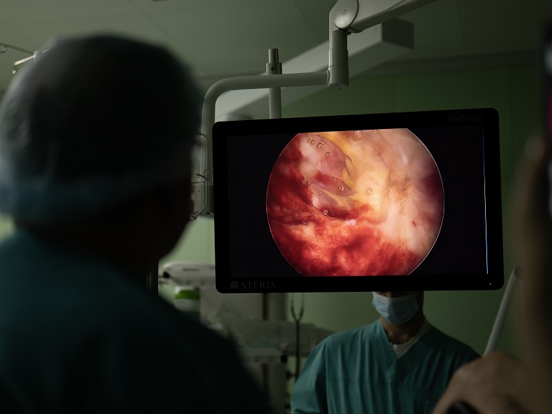 видалення пухлин в урології